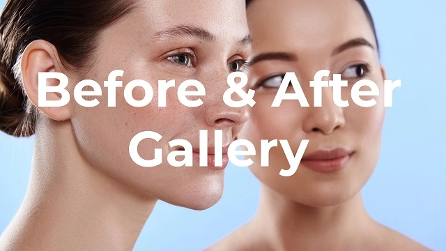 Facial Plastic Surgery Before & After