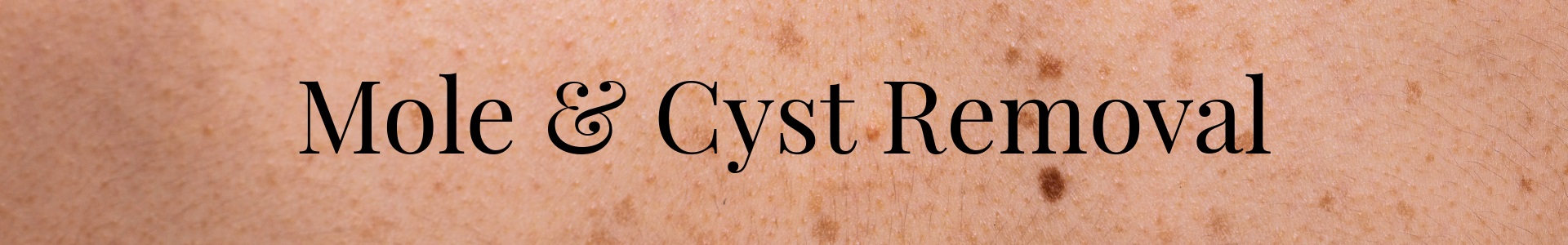 Mole & Cyst Removal Portland